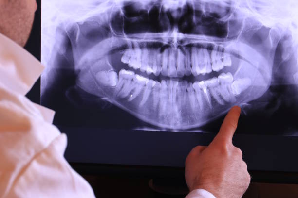 Best Emergency Dental Care for Sports Injuries in Bowleys Quarters, MD